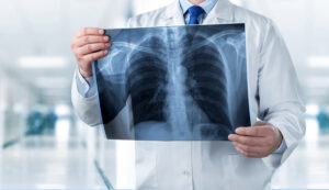 Importance of radiology treatment wise