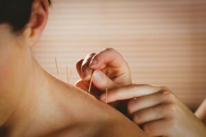 Inform people about the benefits of acupuncture