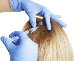 Hair loss treatments available via medication