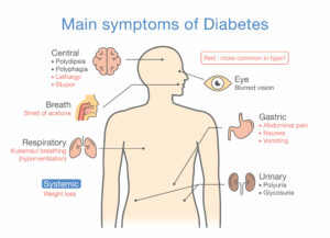 Symptoms Of Type 1 Diabetes