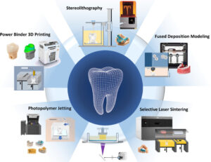 The Advancement of 3D Imprinting in Dentistry