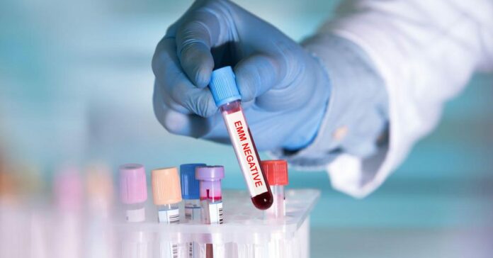 Rajkotupdates.news: Emm Negative Rare Blood Group